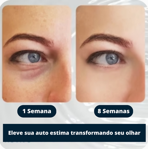 Gel Antienvelhecimento - Le Belle