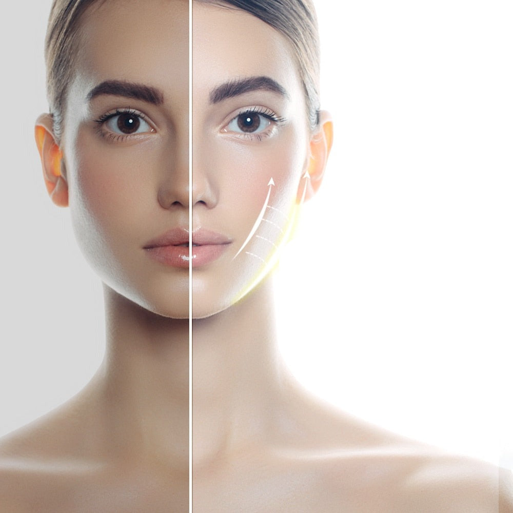 Levantamento Facial  - Le Belle