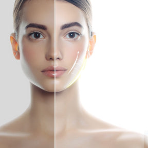 Levantamento Facial  - Le Belle